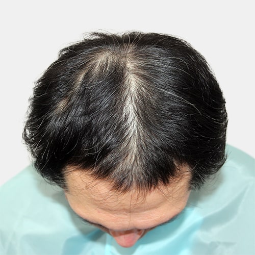 before,after