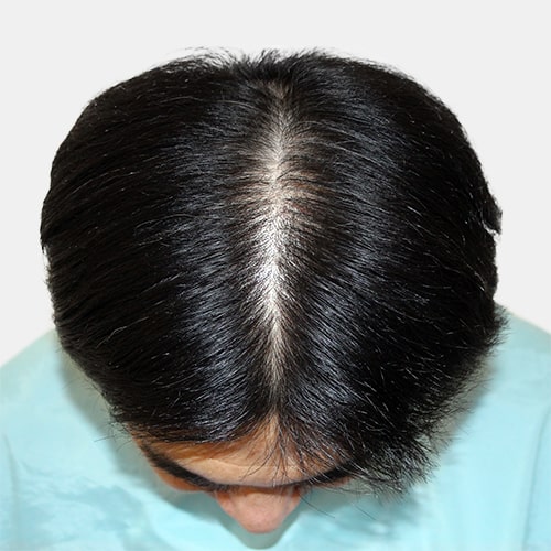before,after